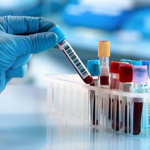 Diagnostic Laboratory Services